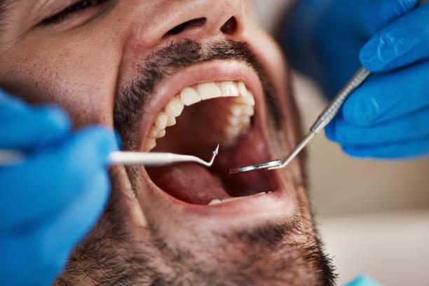 Emergency Dental Care for Seniors