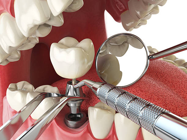 Best After-Hours Dental Trauma Care in Victoria, KS